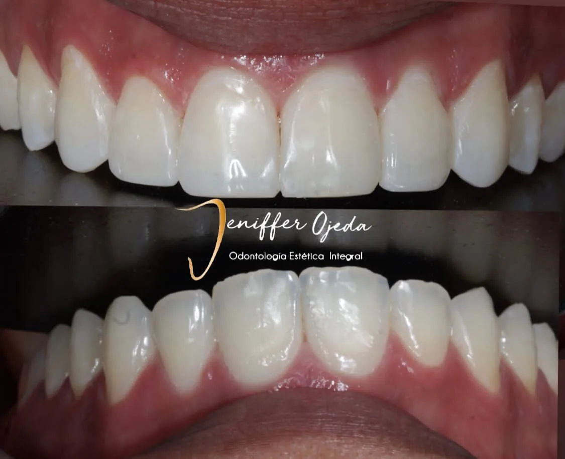 Servicios odontológicos y estéticos ofrecidos por la clínica Jeniffer Ojeda en Medellín